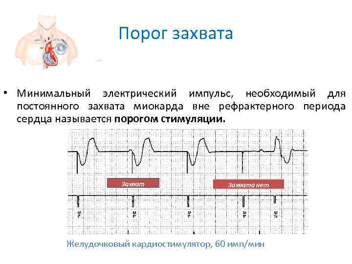      Порог захвата • Минимальный электрический импульс,  необходимый для
