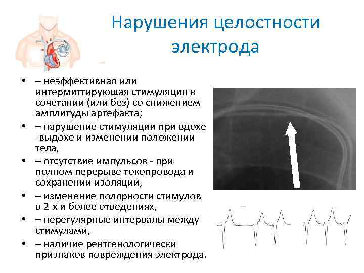     Нарушения целостности    электрода • – неэффективная или