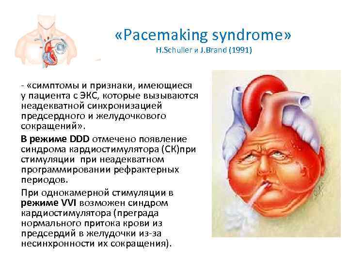     «Рacemaking syndrome»     H. Schuller и J.