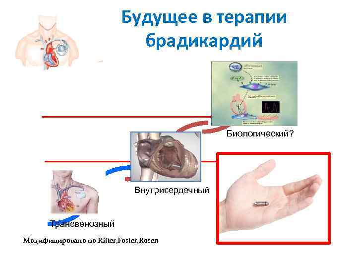        Будущее в терапии    