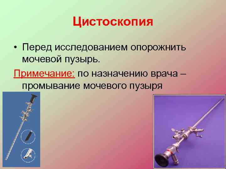   Цистоскопия • Перед исследованием опорожнить  мочевой пузырь. Примечание: по назначению врача