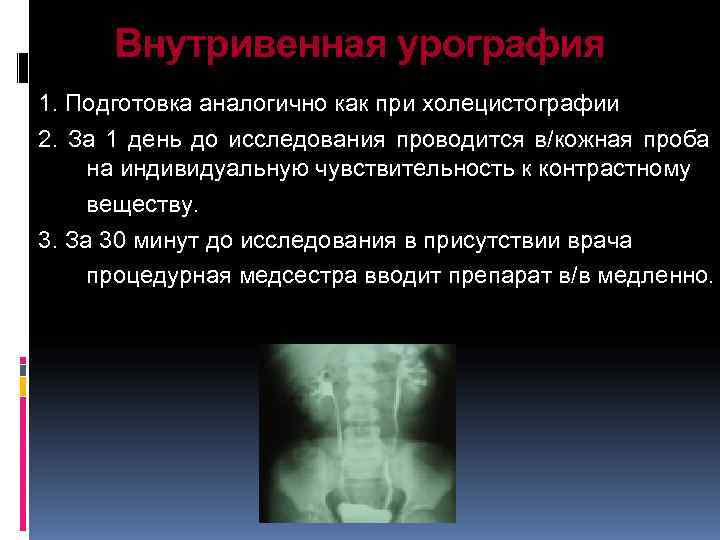  Внутривенная урография 1. Подготовка аналогично как при холецистографии 2. За 1 день до