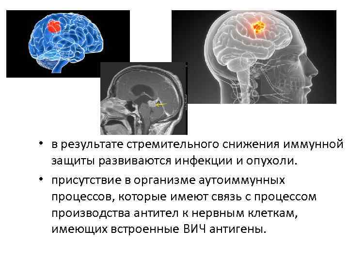 Нейроспид неврология презентация