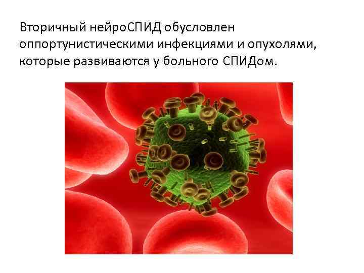 Вторичный нейро. СПИД обусловлен оппортунистическими инфекциями и опухолями,  которые развиваются у больного СПИДом.