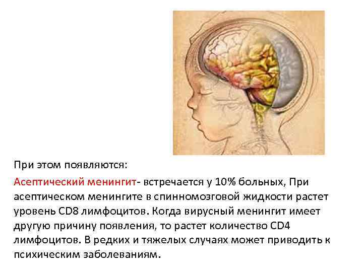 При этом появляются: Асептический менингит- встречается у 10% больных, При асептическом менингите в спинномозговой