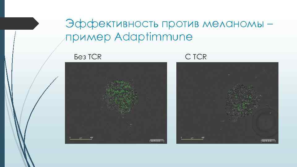 Эффективность против меланомы – пример Adaptimmune Без TCR   C TCR 