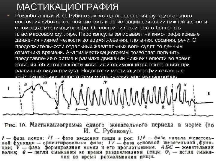   МАСТИКАЦИОГРАФИЯ •  Разработанный И. С. Рубиновым метод определения функционального состояния зубочелю-стной