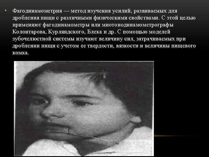  • Фагодинамометрия — метод изучения усилий, развиваемых для  дробления пищи с различными