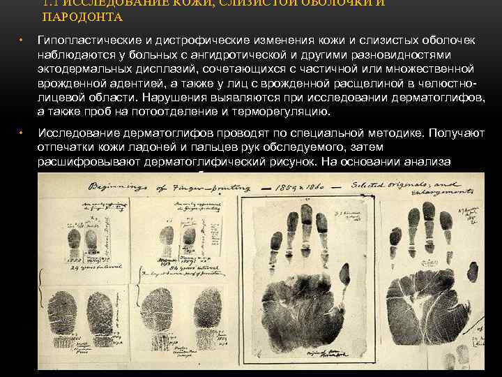   1. 1 ИССЛЕДОВАНИЕ КОЖИ, СЛИЗИСТОЙ ОБОЛОЧКИ И ПАРОДОНТА •  Гипопластические и