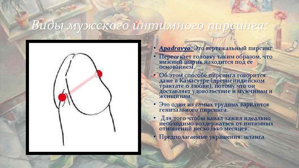 Виды мужского интимного пирсинга: • Apadravya: Это вертикальный пирсинг. Виды мужского интимного пирсинга: • Apadravya: Это вертикальный пирсинг.