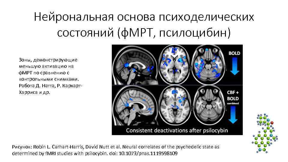 Нейрональная основа психоделических состояний (ф. МРТ, псилоцибин) Зоны, Нейрональная основа психоделических состояний (ф. МРТ, псилоцибин) Зоны,