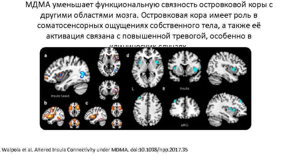 МДМА уменьшает функциональную связность островковой коры с другими МДМА уменьшает функциональную связность островковой коры с другими