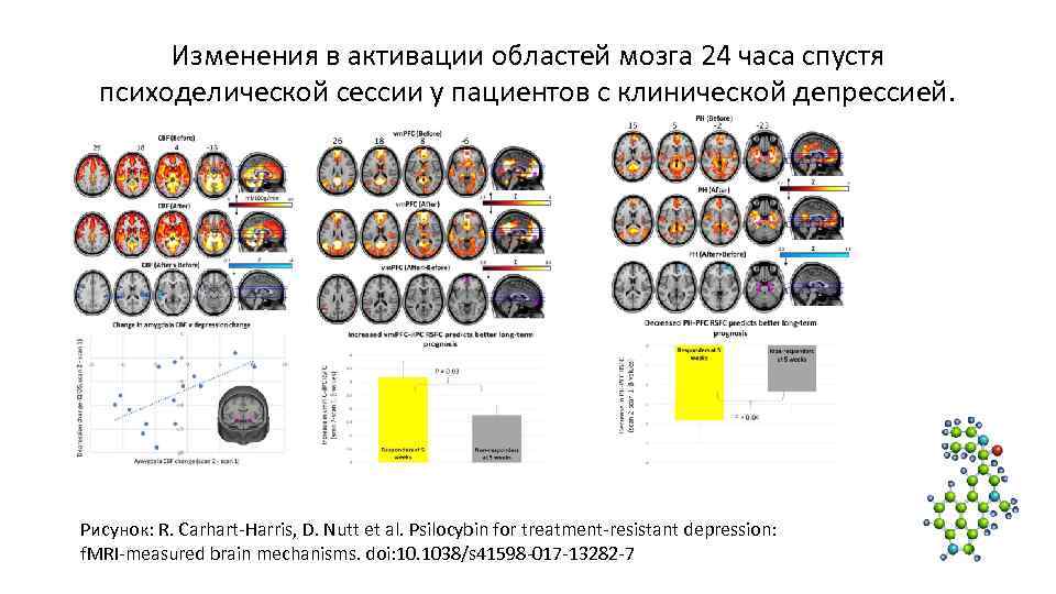 Изменения в активации областей мозга 24 часа спустя психоделической сессии у Изменения в активации областей мозга 24 часа спустя психоделической сессии у