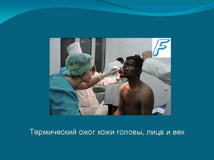 Термический ожог кожи головы, лица и век 