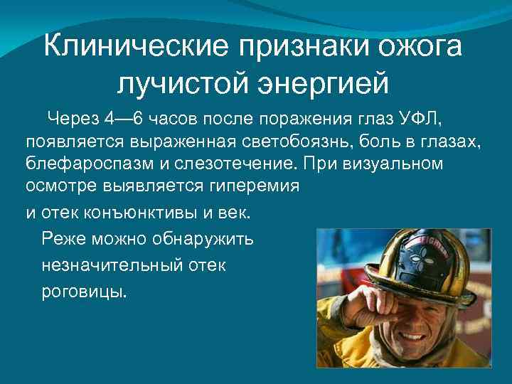  Клинические признаки ожога лучистой энергией  Через 4— 6 часов после поражения глаз