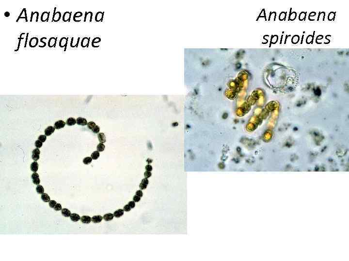 • Anabaena  flosaquae  spiroides 
