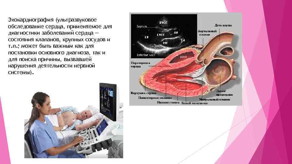 Эхокардиография (ультразвуковое обследование сердца, применяемое для диагностики заболеваний сердца — состояния клапанов, крупных сосудов