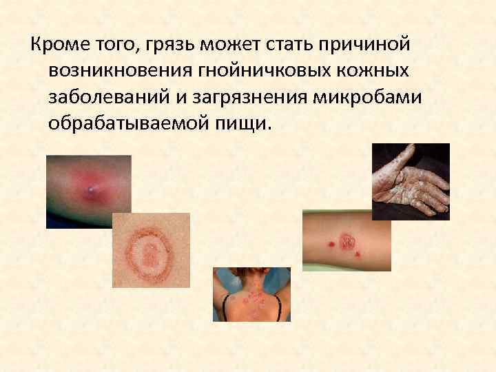 Кроме того, грязь может стать причиной  возникновения гнойничковых кожных  заболеваний и загрязнения