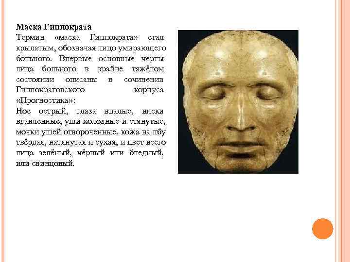 Маска Гиппократа Термин  «маска Гиппократа»  стал крылатым, обозначая лицо умирающего больного. 