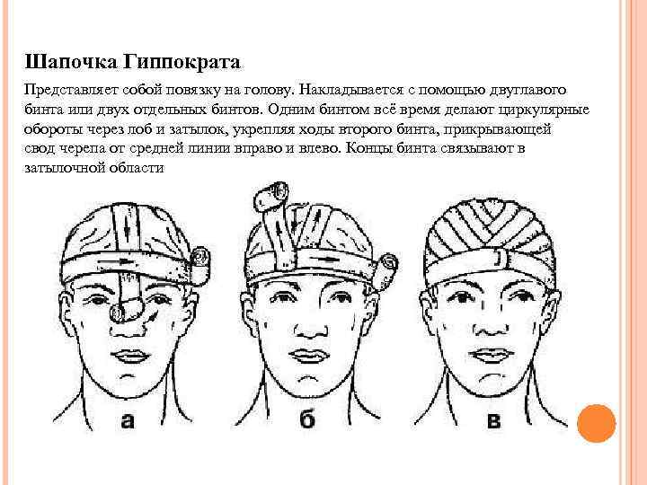 Шапочка гиппократа повязка фото