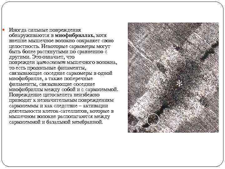 Иногда сильные повреждения обнаруживаются в миофибриллах, хотя внешне мышечное волокно сохраняет Иногда сильные повреждения обнаруживаются в миофибриллах, хотя внешне мышечное волокно сохраняет