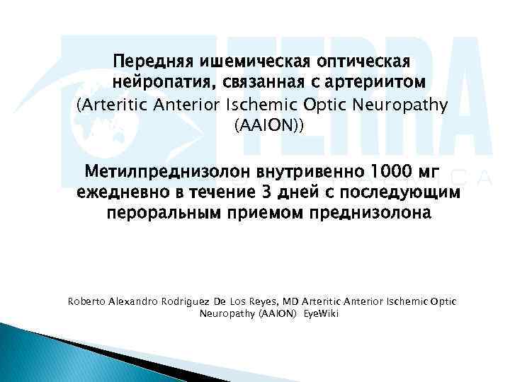  Передняя ишемическая оптическая  нейропатия, связанная с артериитом (Arteritic Anterior Ischemic Optic Neuropathy