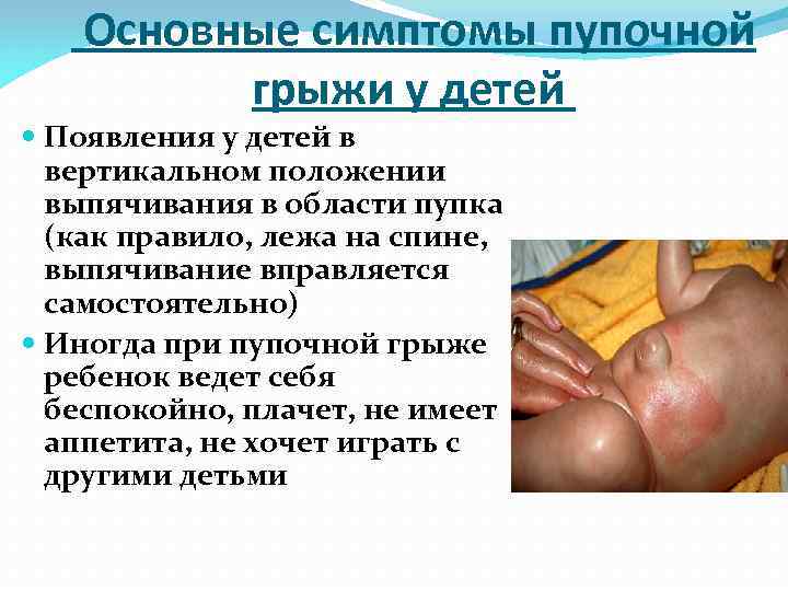 >  Основные симптомы пупочной  грыжи у детей Появления у детей в 