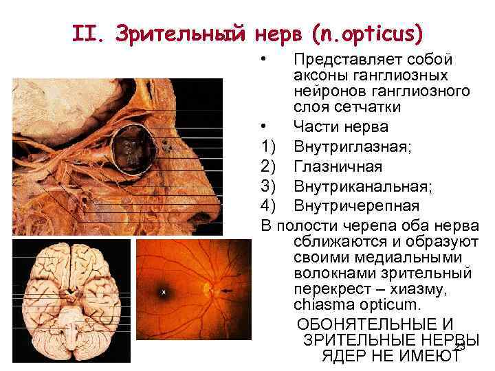 II. Зрительный нерв (n. opticus)   •  Представляет собой   