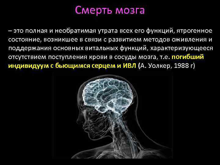 Смерть мозга – это полная и необратимая утрата всех его функций, ятрогенное состояние, возникшее