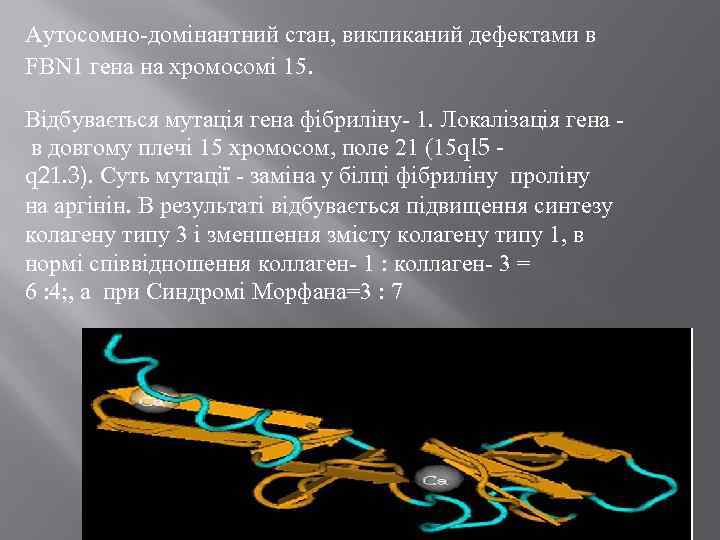 Аутосомно-домінантний стан, викликаний дефектами в FBN 1 гена на хромосомі 15. Відбувається мутація гена