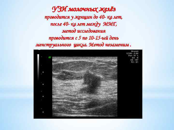 УЗИ молочных желёз проводится у женщин до 40 - ка лет, после 40 -