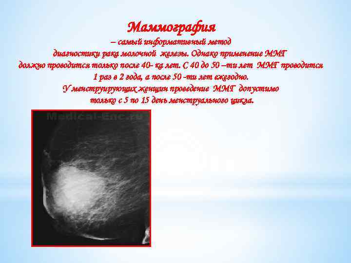 Маммография – самый информативный метод диагностики рака молочной железы. Однако применение ММГ должно проводится
