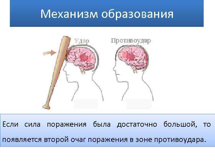 Удар мозга последствия. Повреждение головного мозга. Травмы головного мозга причины. Ушиб головного мозга этиология.