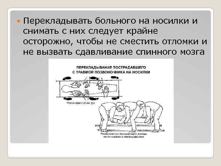  Перекладывать больного на носилки и снимать с них следует крайне осторожно, чтобы не