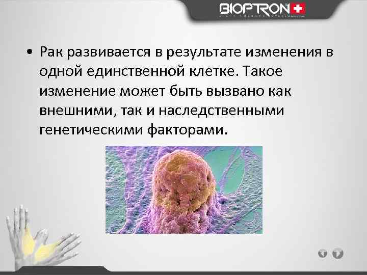  • Рак развивается в результате изменения в одной единственной клетке. Такое изменение может