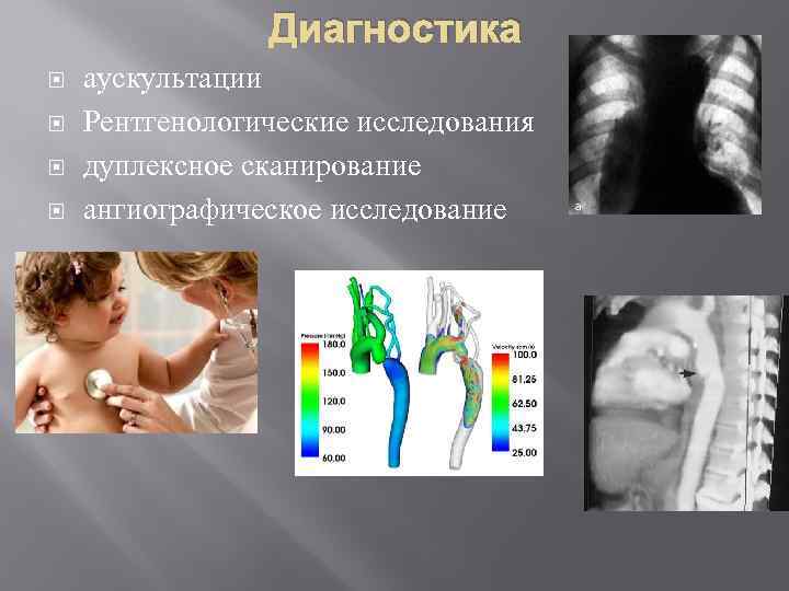 Диагностика аускультации Рентгенологические исследования дуплексное сканирование ангиографическое исследование 