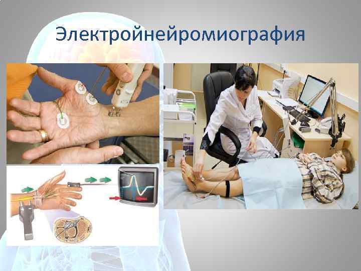 Электройнейромиография 