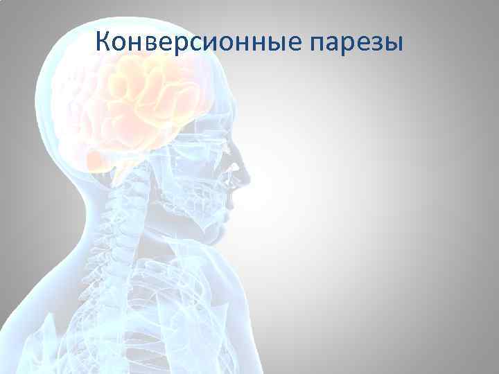 Конверсионные парезы 
