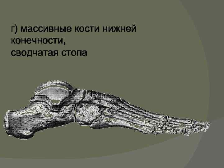 г) массивные кости нижней конечности, сводчатая стопа 