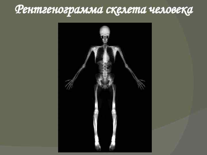 Рентгенограмма скелета человека 