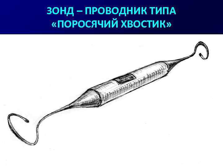 ЗОНД – ПРОВОДНИК ТИПА «ПОРОСЯЧИЙ ХВОСТИК» 