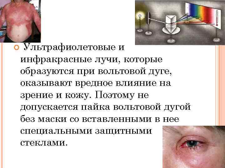  Ультрафиолетовые и инфракрасные лучи, которые образуются при вольтовой дуге, оказывают вредное влияние на