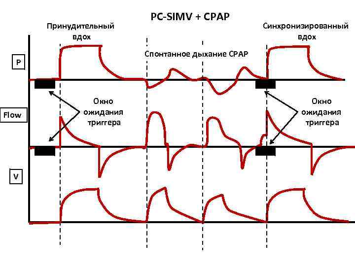 Принудительный вдох V Синхронизированный вдох Спонтанное дыхание СРАР P Flow PC-SIMV + CPAP Окно