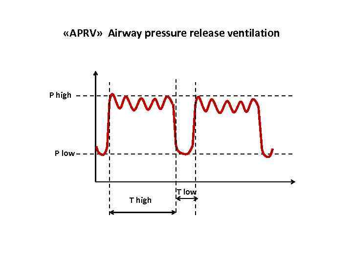  «APRV» Airway pressure release ventilation P high P low T high T low