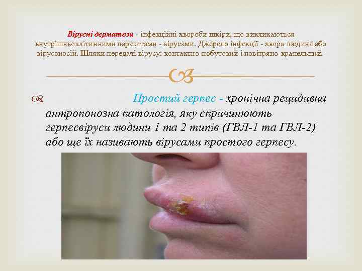 Вірусні дерматози - інфекційні хвороби шкіри, що викликаються внутрішньоклітинними паразитами - вірусами. Джерело інфекції