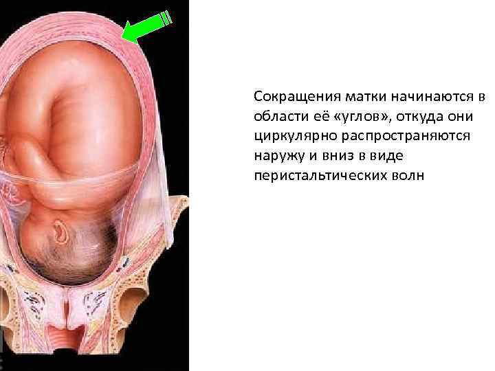 Сокращения матки начинаются в области её «углов» , откуда они циркулярно распространяются наружу и