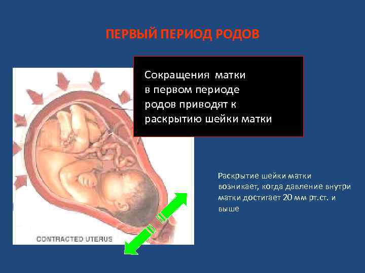 ПЕРВЫЙ ПЕРИОД РОДОВ Сокращения матки в первом периоде родов приводят к раскрытию шейки матки