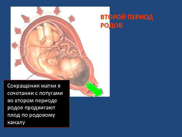 ВТОРОЙ ПЕРИОД РОДОВ Сокращения матки в сочетании с потугами во втором периоде родов продвигают