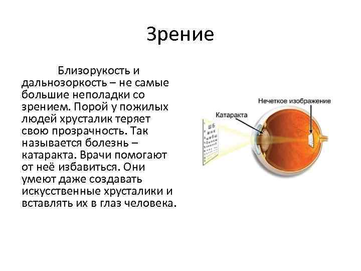 Зрение Близорукость и дальнозоркость – не самые большие неполадки со зрением. Порой у пожилых