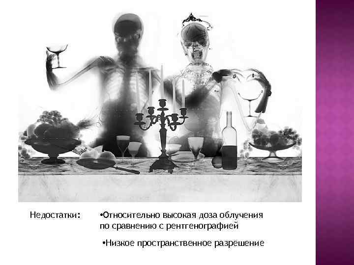 Недостатки: • Относительно высокая доза облучения по сравнению с рентгенографией • Низкое пространственное разрешение